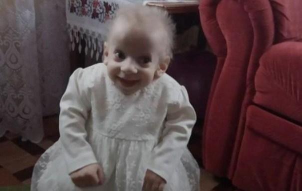 В Украине от старости умерла восьмилетняя девочка