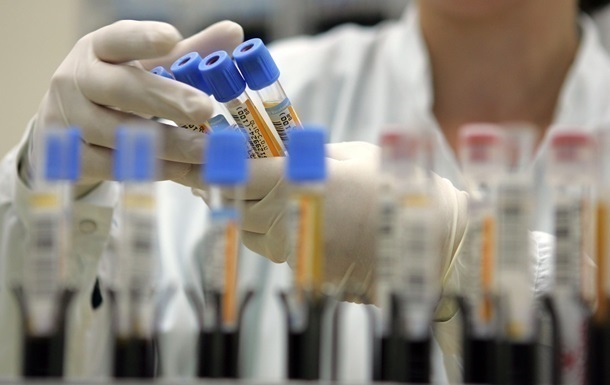 В Украине лишь 8 областей закупили тест-системы для выявления коронавируса