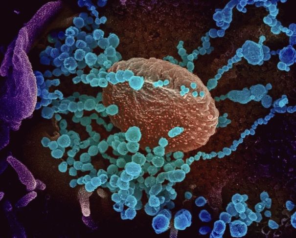 Ученые выявили еще одно опасное свойство коронавируса