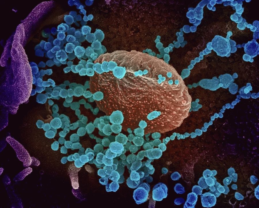 Ученые назвали еще один орган-мишень, по которому бьет коронавирус