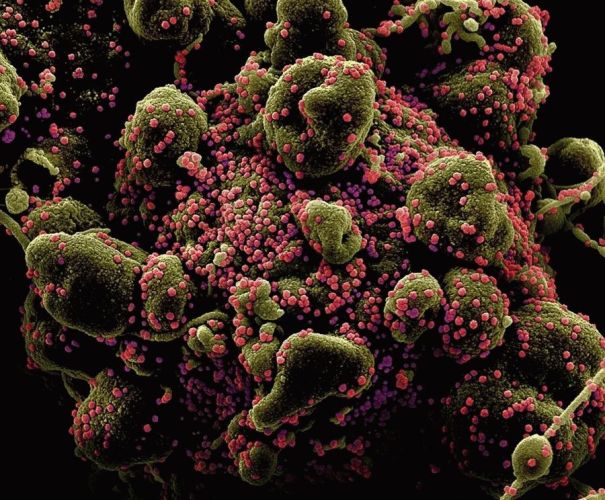 Ученые показали, как выглядит коронавирус