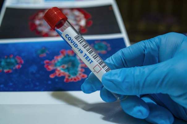 В Украине коронавирусом заболели еще 578 человек: Минздрав назвал причину